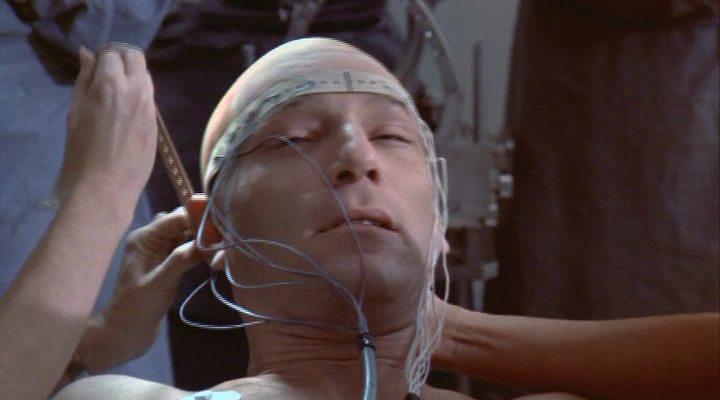 Кадр из фильма Человек, несущий смерть / The Terminal Man (1974)