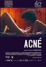 Угри / Acné (2008)